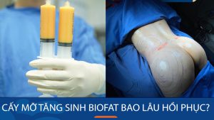 Thời gian hồi phục sau khi cấy mỡ tăng sinh BioFat cho mông lép là bao lâu?