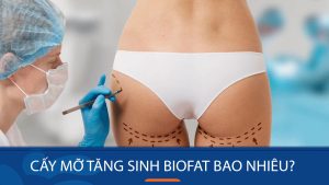 Cấy mỡ tăng sinh BioFat cho mông lép giá bao nhiêu?