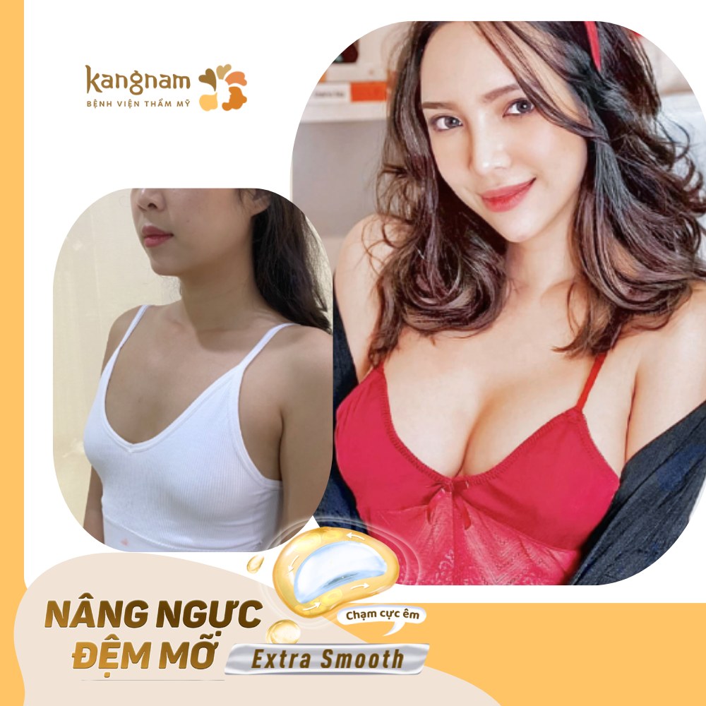 Kiêng cữ sau nâng ngực đệm mỡ giúp vòng 1 nhanh chóng phục hồi