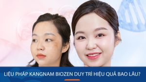 Liệu pháp Kangnam BIOZEN kéo dài hiệu quả bao lâu?