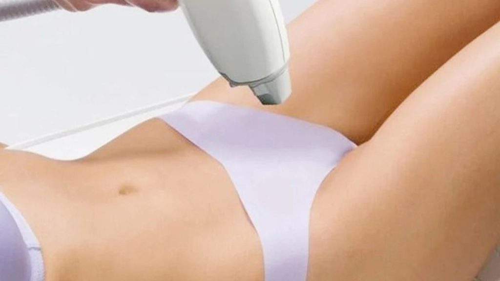 Hình ảnh sau khi triệt lông vùng kín? cần lưu ý điều gì