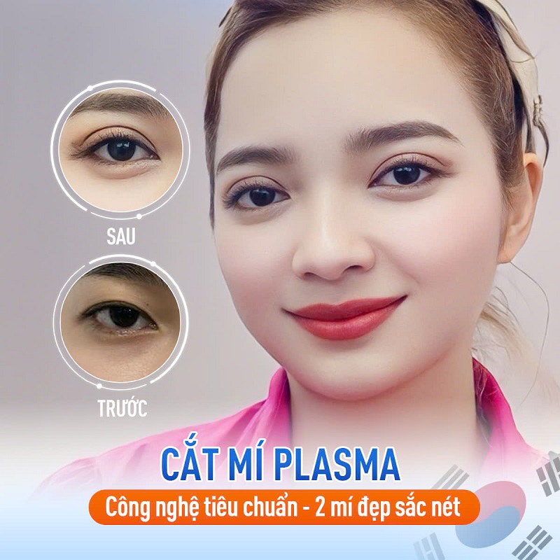 Kangnam ứng dụng đa dạng các công nghệ cắt mí
