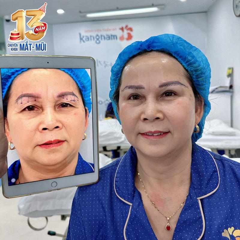 Nhân dịp sinh nhật chuyên khoa Mắt - mũi, Kangnam tung ra nhiều chương trình khuyến mãi hấp dẫn