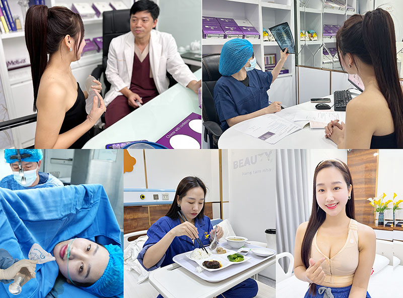 Quy trình nâng ngực tại Kangnam diễn ra chuẩn y khoa