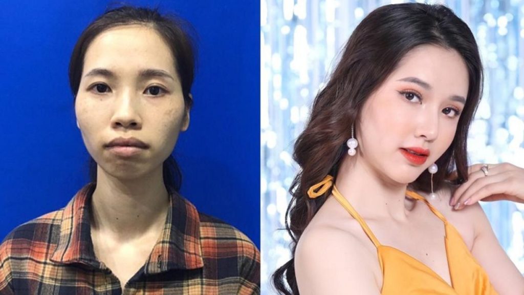 Hành trình Lột xác: Show truyền hình về phẫu thuật thẩm mỹ 6 năm chưa hạ nhiệt