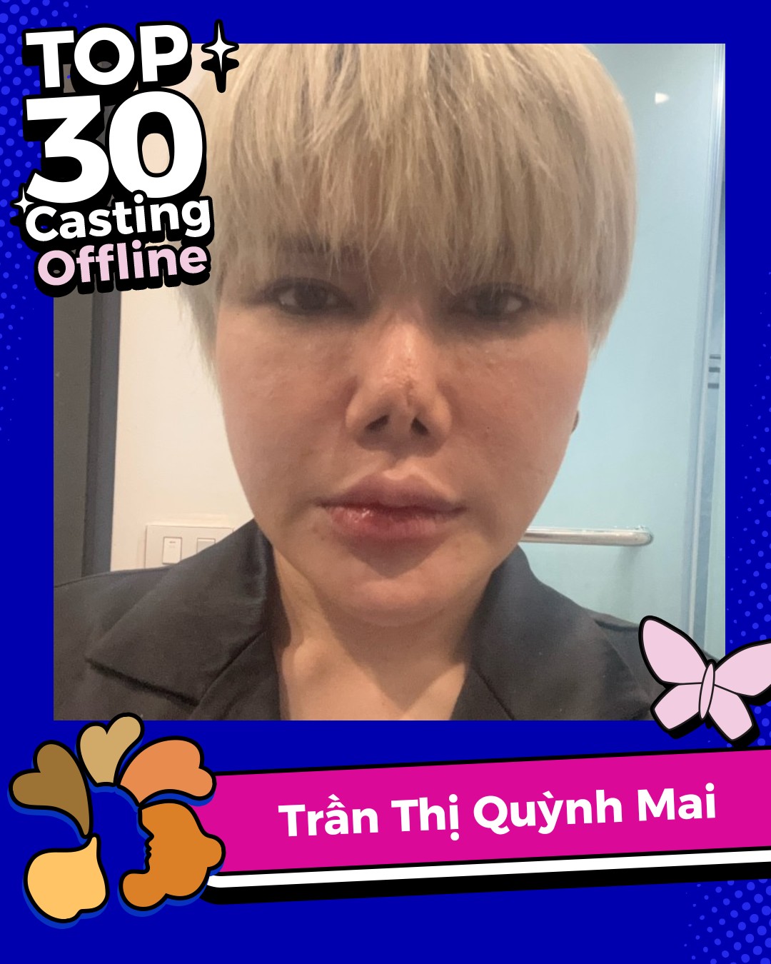 Tình trạng phẫu thuật thẩm mỹ hỏng của Quỳnh Mai
