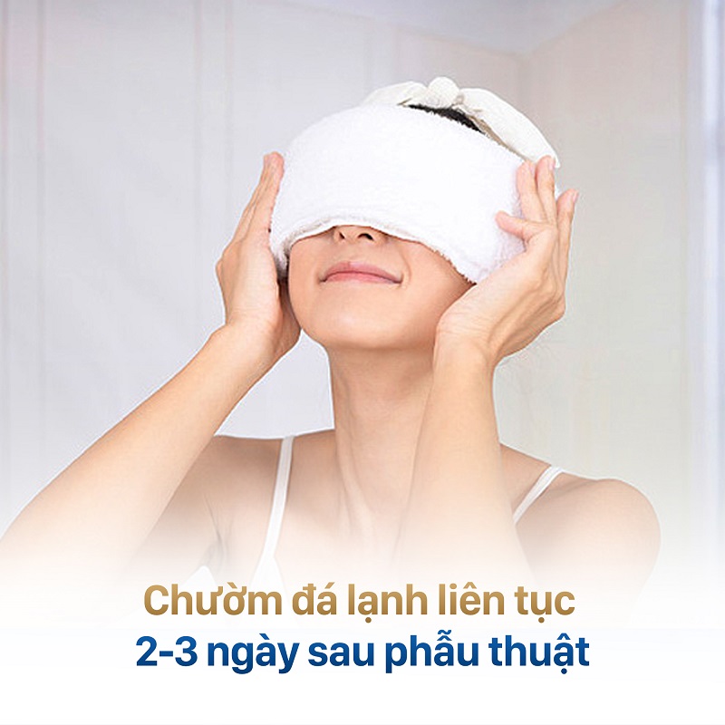 Chườm lạnh liên tục sau khi cắt mí 2 ngày