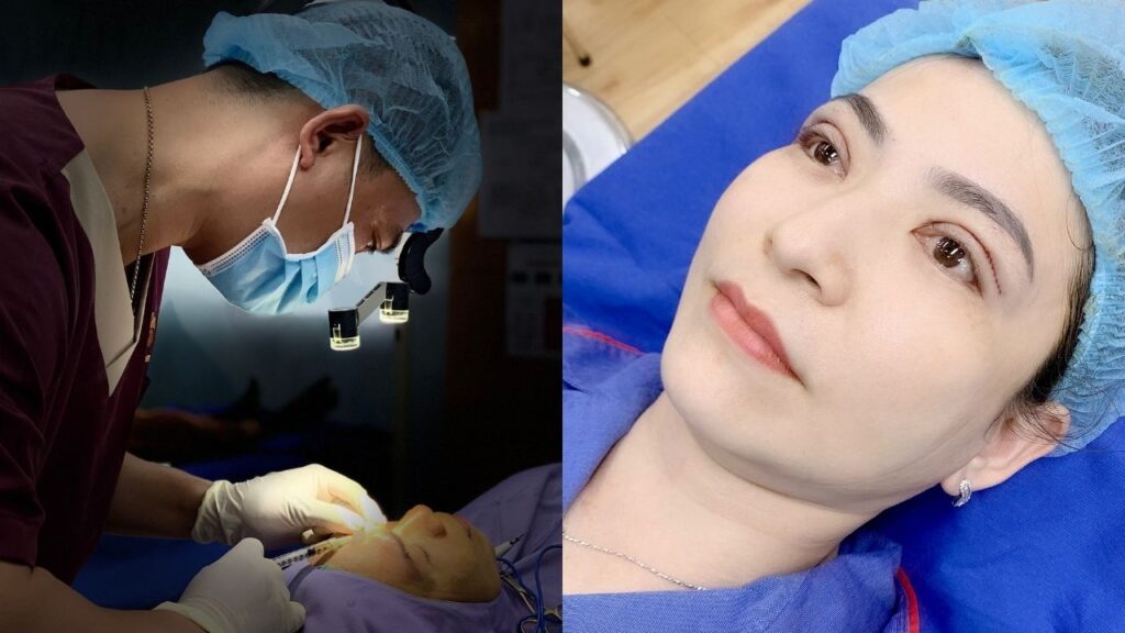 Cắt mí mắt có đau không? Những cách giảm đau hiệu quả