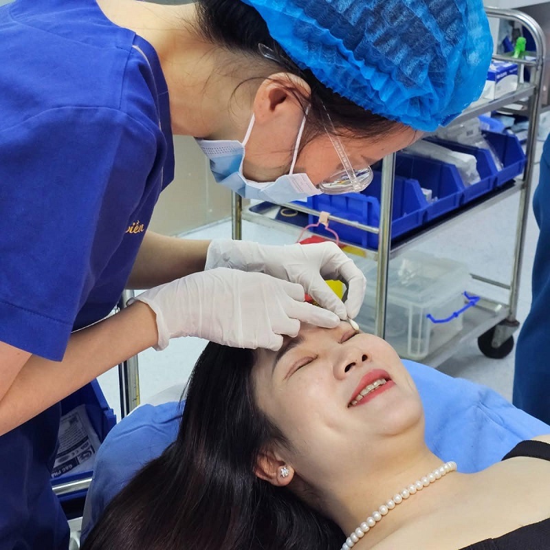 Quá trình cắt chỉ sau cắt mí tại Kangnam diễn ra nhẹ nhàng
