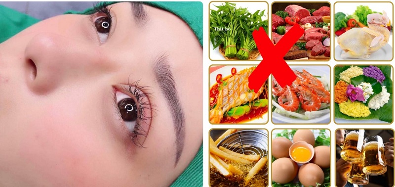 Tránh ăn các thực phẩm gây sưng tấy mí mắt