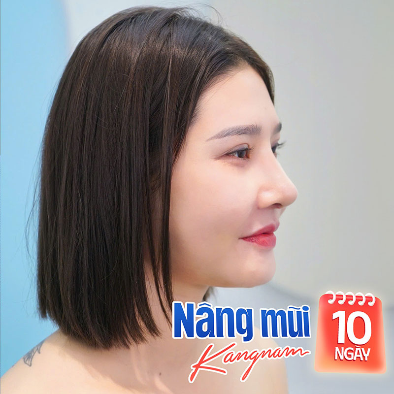 Khách hàng tại Kangnam hồi phục nhanh nhờ chế độ chăm sóc khoa học