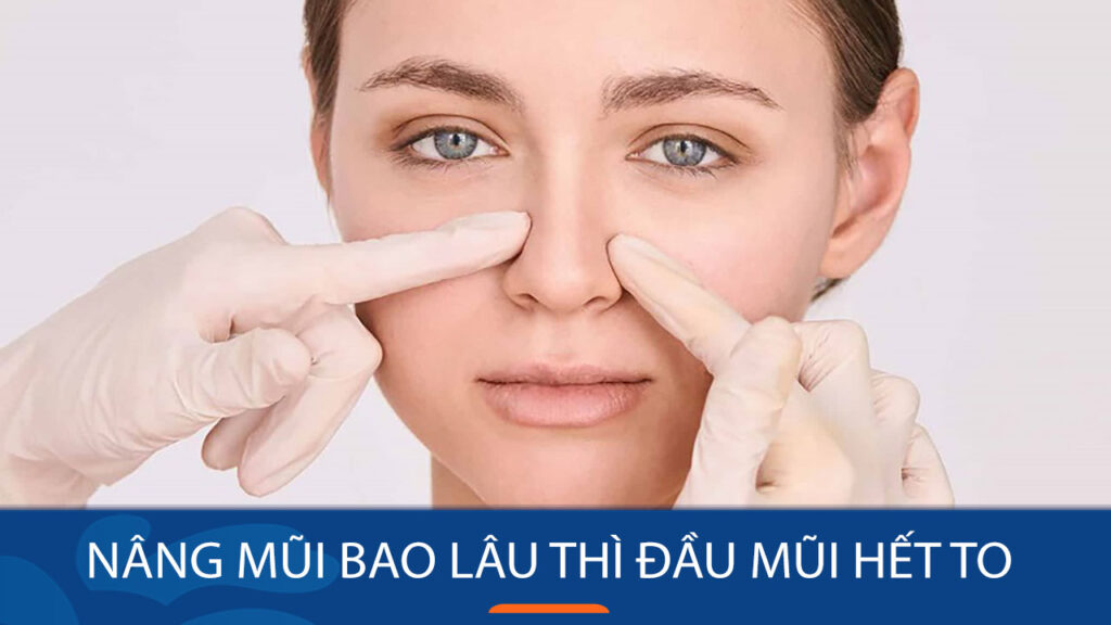 Nâng mũi bao lâu thì đầu mũi hết to? Cách chăm sóc nhanh lành
