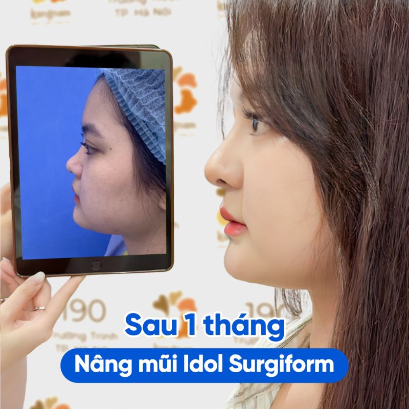 Dáng mũi thanh thoát, tự nhiên sau nâng tại Kangnam.