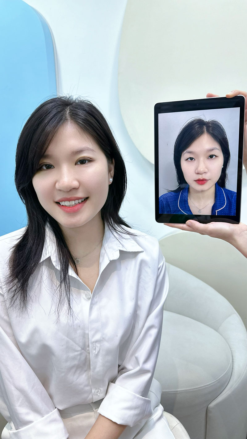 Mí mắt cân đối, hài hòa với tổng thể gương mặt