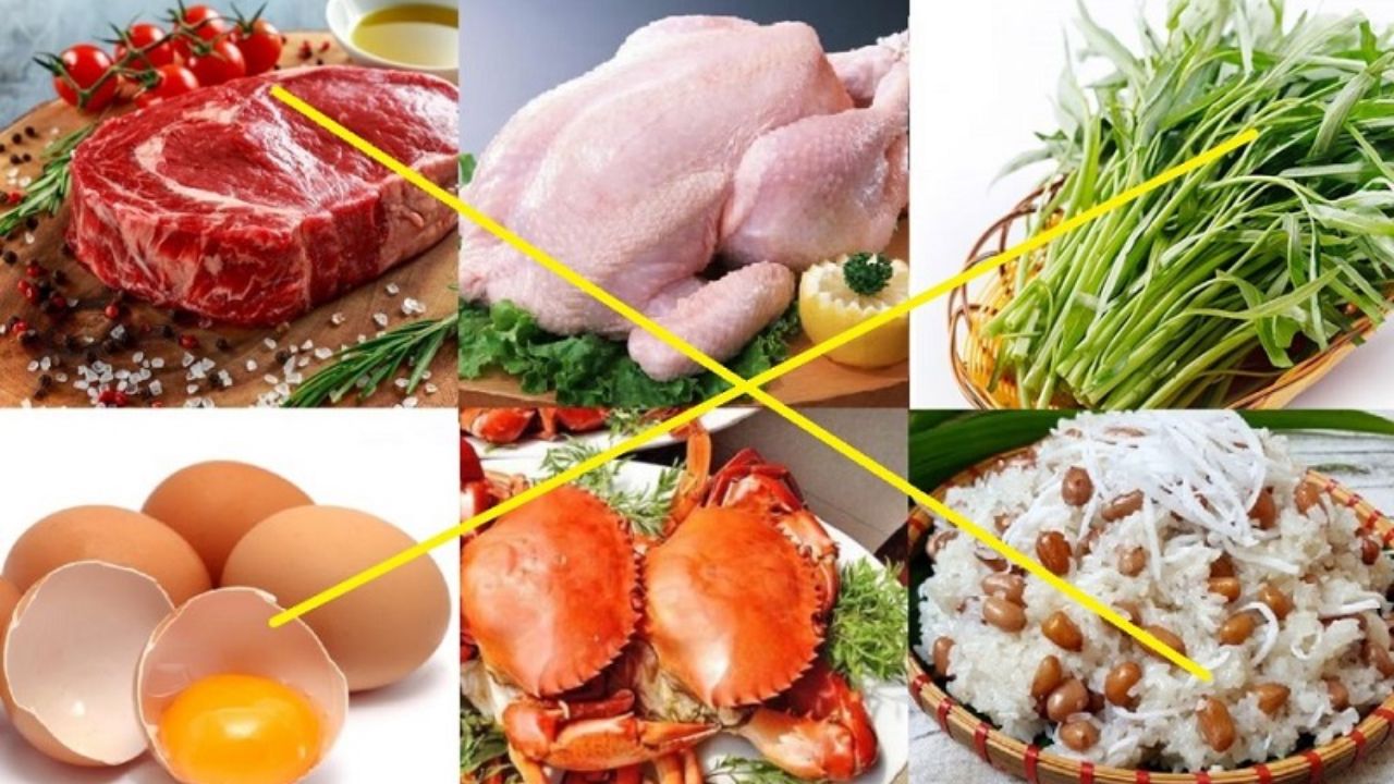 Sửa mũi kiêng ăn gì? Danh sách thực phẩm cần tránh