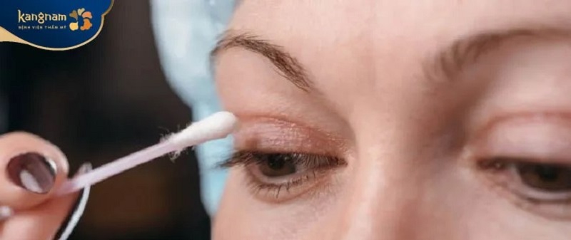 Dùng tăm bông thấm kem trị sẹo và thoa lên mí mắt