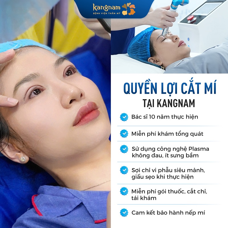 Tại Kangnam khách hàng được cắt mí bằng dao mổ Plasma, dùng chỉ vi phẫu và chiếu tia Plasma lạnh