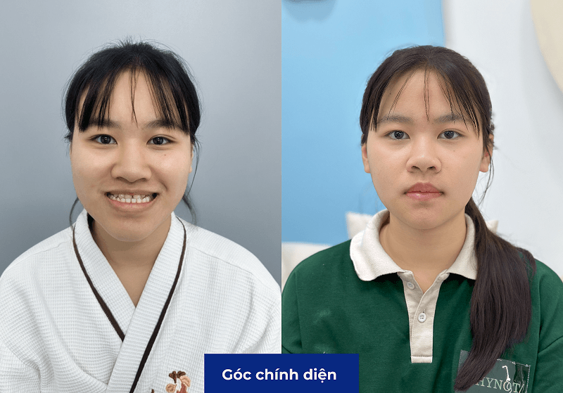 Gương mặt khách hàng có sự thay đổi đáng kể nhưng vẫn giữ được nét riêng