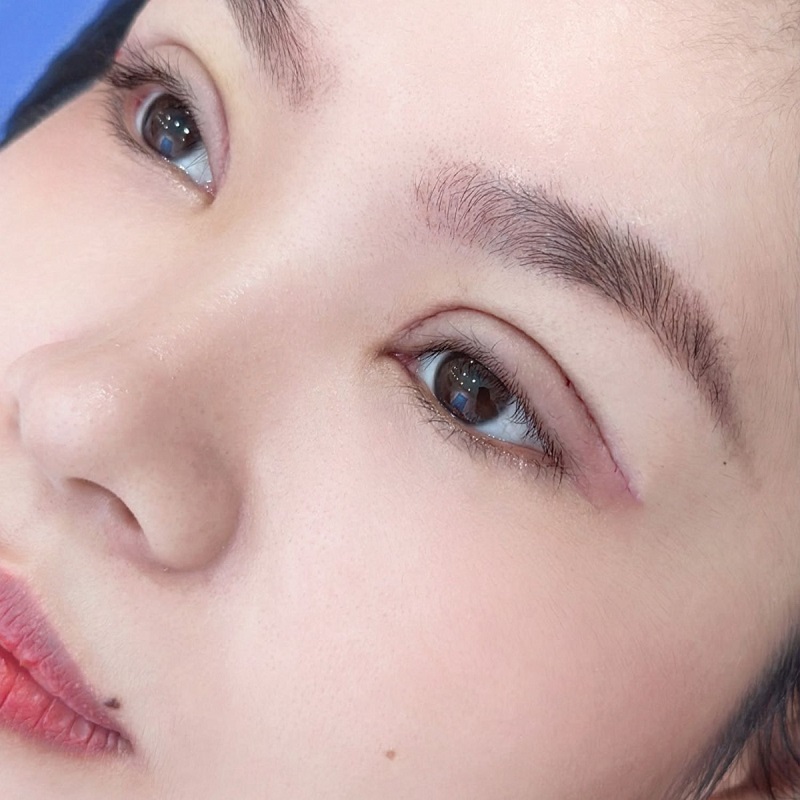 Cắt mí tại Kangnam giúp khách hàng sở hữu mắt hai mí rõ nét, hài hòa và tự nhiên