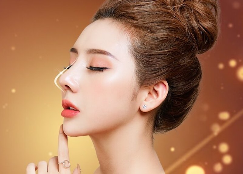 Dáng mũi Vline cao,