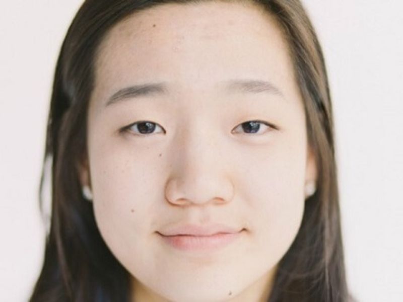 Sống mũi thấp, bè to