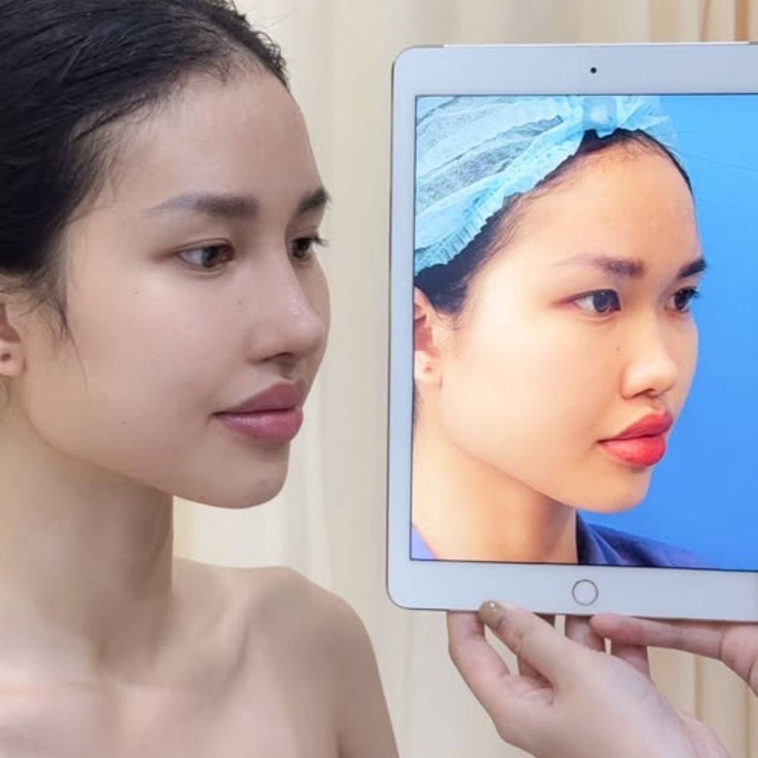 Cân nhắc tái phẫu thuật vùng mũi nếu có nhiều khuyết điểm