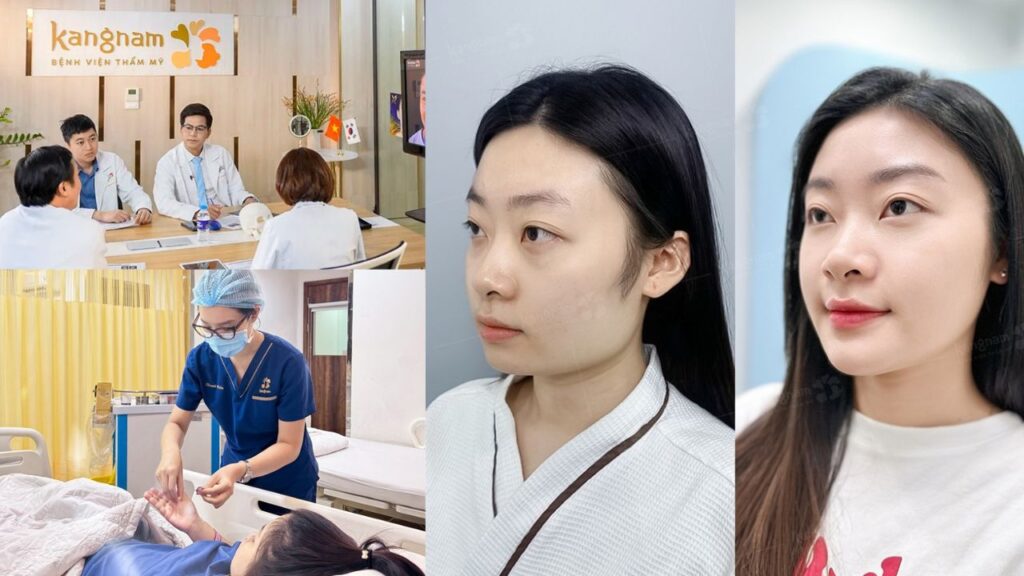 Gọt hàm tại Kangnam Hà Nội – Phẫu thuật hàm mặt an toàn, chuẩn bệnh viện