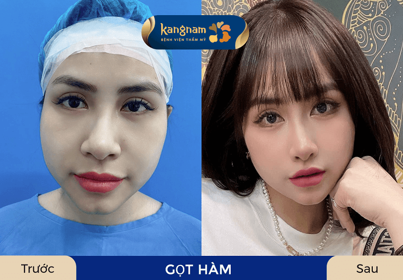 Gương mặt nhỏ gọn, cân đối