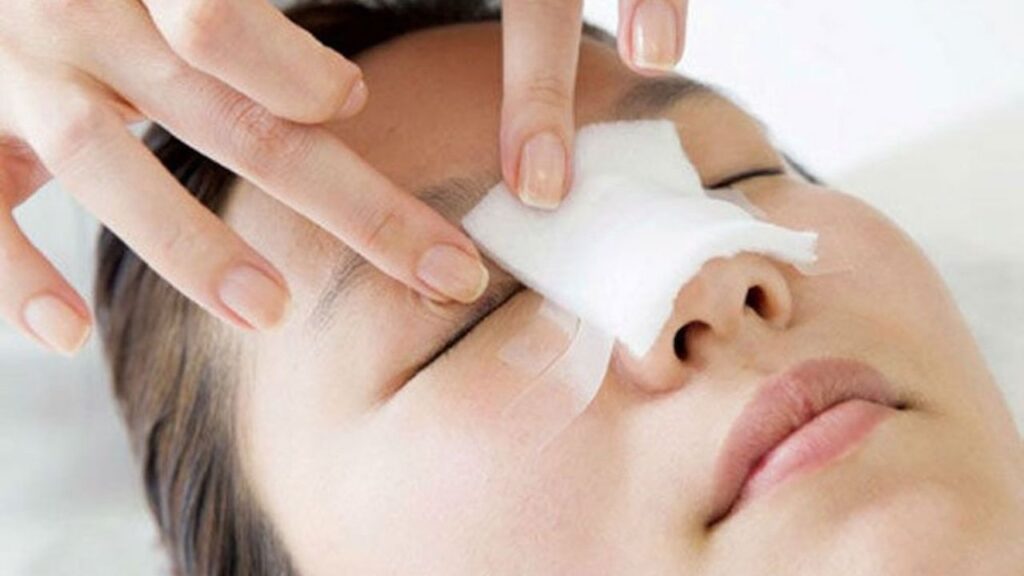 Hậu phẫu nâng mũi: Những điều cần biết sau khi làm mũi