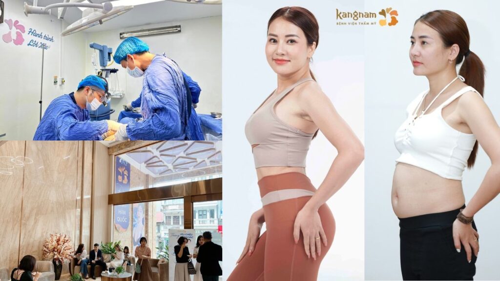 Hút mỡ tại Kangnam Hà Nội – Giải pháp giảm mỡ an toàn, uy tín nhất