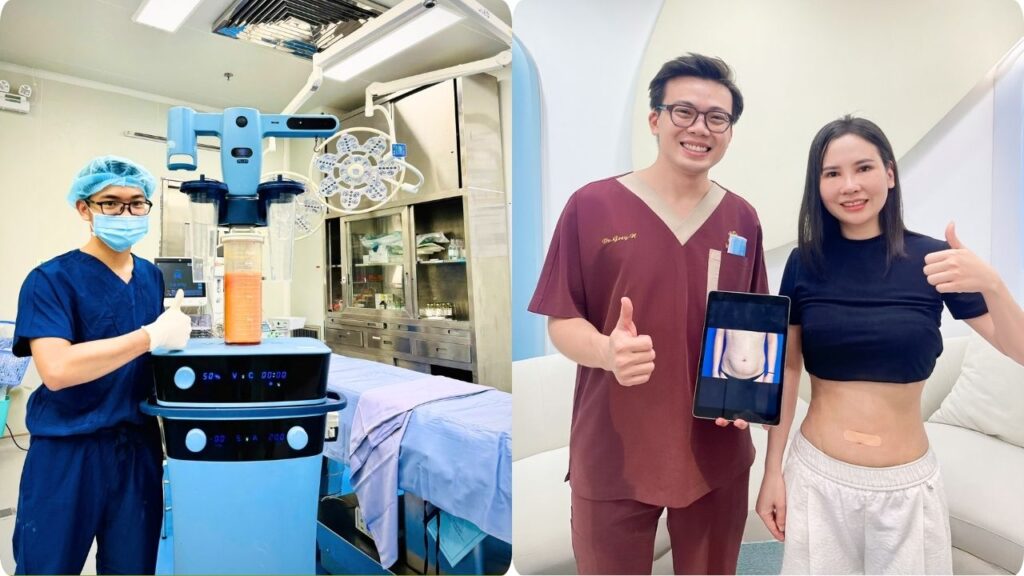 Hút mỡ tại Kangnam TP.HCM – Giải pháp giảm mỡ an toàn, chuẩn y khoa