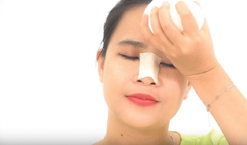 Chườm lạnh xung quanh vùng mũi để giảm sưng đau