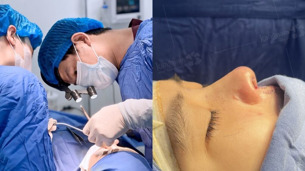 Làm mũi có đau không? Bao lâu thì hết