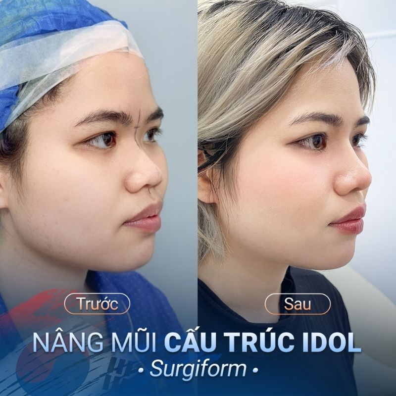 sống mũi thẳng, chụp góc nào cũng thấy xinh