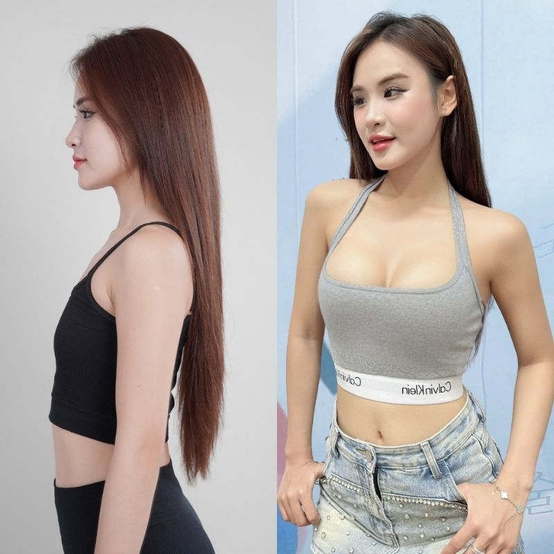 Vòng 1 đầy đặn, cân đối hai bên, kết quả ổn định và tự nhiên