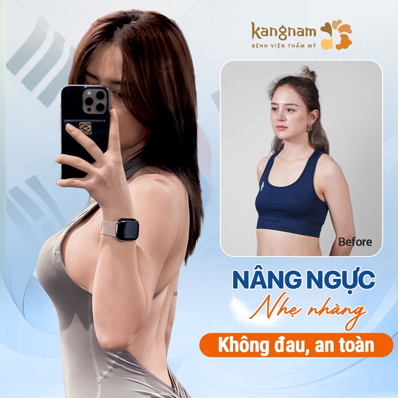 Cải thiện vòng hoàn hảo, đường cho chị em sau nâng ngực 