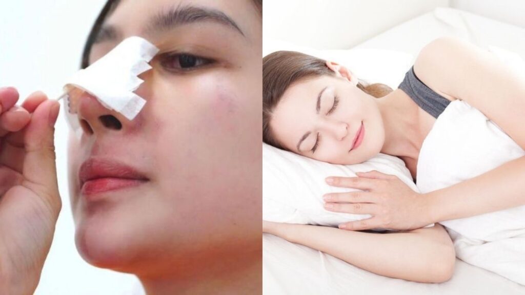 Sinh hoạt sau nâng mũi: Bao lâu thì có thể trở lại bình thường?