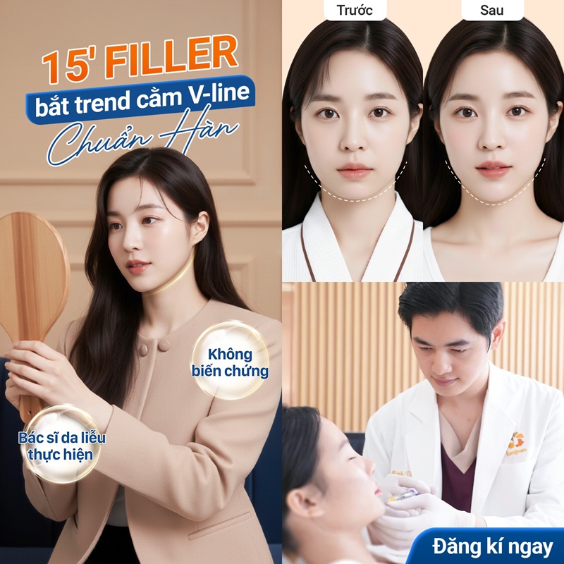 Tiêm Filler trẻ hóa giúp gương mặt Vline
