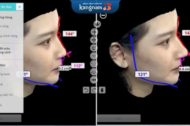 Ứng dụng phần mềm 3D sẽ cho bạn nhìn trước được kết quả 