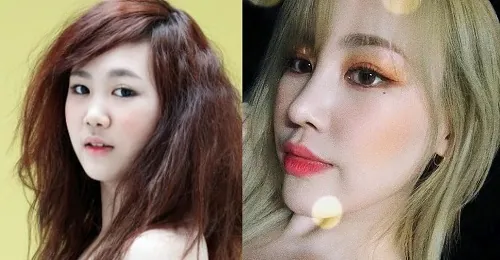 Nhiều sao Hàn gặp khuyết điểm cằm ngắn nhỏ đã quyết định phẫu thuật thẩm mỹ