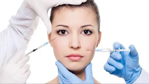 làm đầy rãnh mũi má