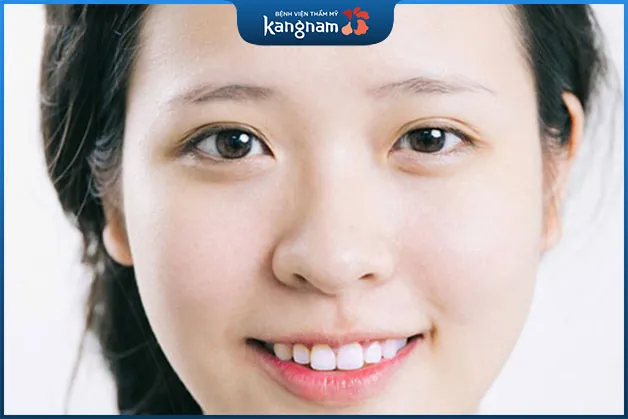 Ánh nhìn của mắt to nhỏ “không có hồn”, không tạo được thiện cảm của người đối diện