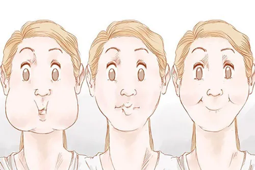 nếp nhăn ngang mũi