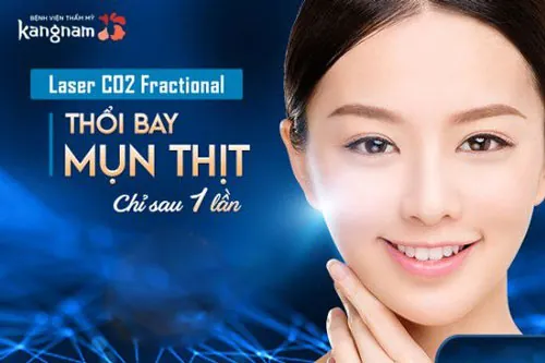 Trị mụn thịt ở mũi bằng công nghệ Laser CO2 Fractional có thể thổi bay mụn thịt trong 1 lần trị mụn thịt ở mũi