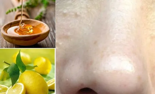 Trị mụn thịt trên mũi bằng chanh sẽ mang lại hiệu quả nếu kiên trì thực hiện đều đặn trị mụn thịt trên mũi
