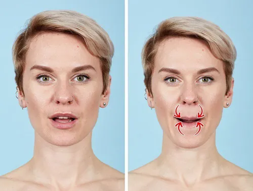 nếp nhăn cánh mũi