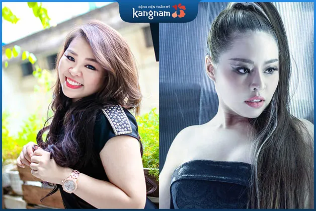 Ca sĩ Thái Bảo Trâm "lột xác" sau giảm mỡ mặt