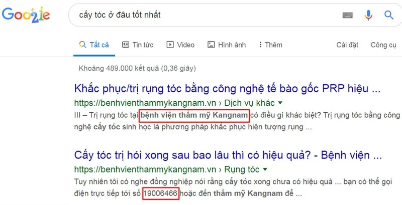 cấy tóc ở đâu
