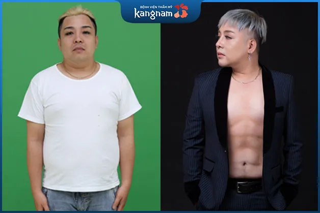 Chàng ca sĩ người Philippines Alvir Antoine