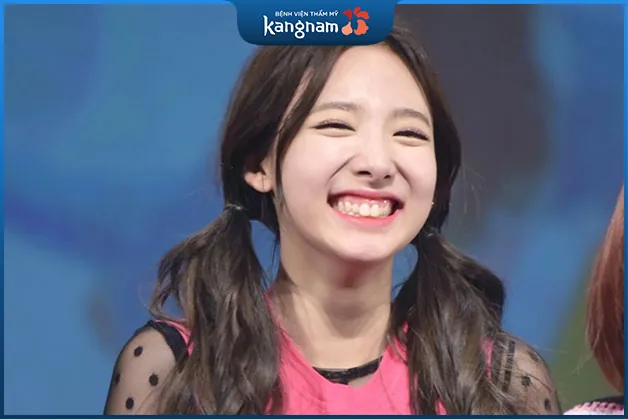 Cười hở có di truyền không?